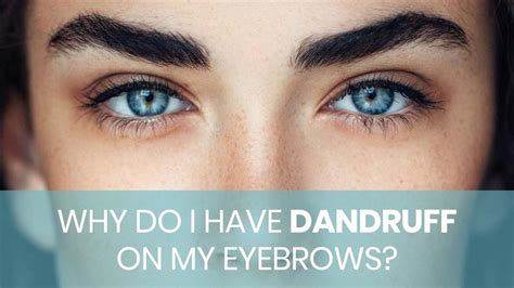 It is perfectly safe to eat raw, and you can. Why Do I Have Dandruff On My Eyebrows? | Manage Dandruff