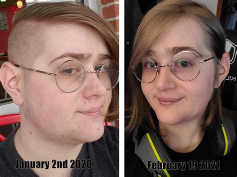 A Little Over A Year Of Weight Loss Hair Growth And 4 Months Of Hrt