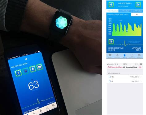 Microsoft team, could you please put some priority to this request we are using teams for our out of hours service and having the apple watch ring when a teams call is received would be very useful for very late calls. On Heart Rate Variability and the Apple Watch - Marco ...