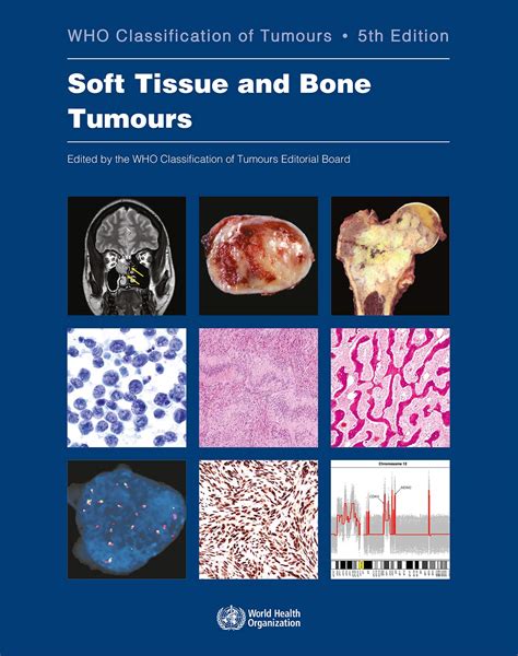 Who Classification Of Tumours Of Soft Tissue And Bone Tumours 3 World