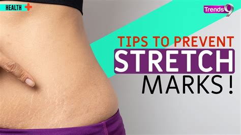 Can You Prevent Stretch Marks Stretch Marks During Pregnancy Stretchmarksprevention Youtube