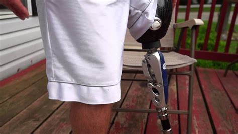 Amputeeot How An Above Knee Ak Prosthetic Leg Works