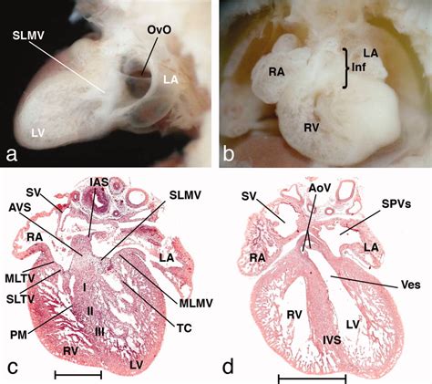 Chronological And Morphological Study Of Heart Development In The Rat