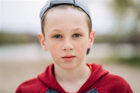 Close Up Portrait Teenage Boy Freckles His Face Stock Photos Free