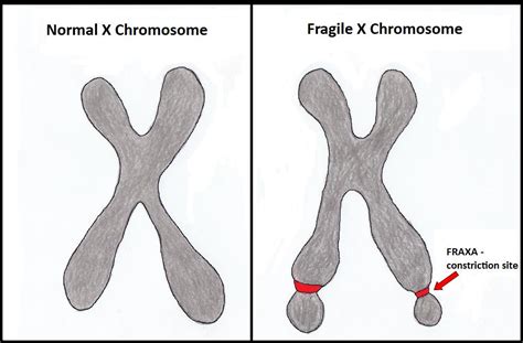 Chromosome Fragility