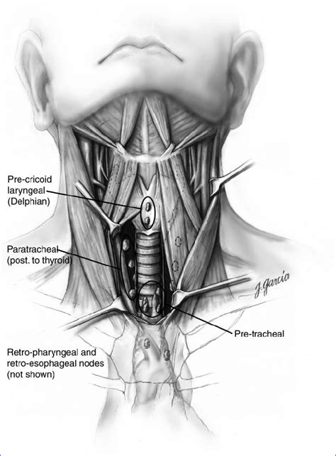 Detailed Anterior View Of The Central Neck Compartment Indicating