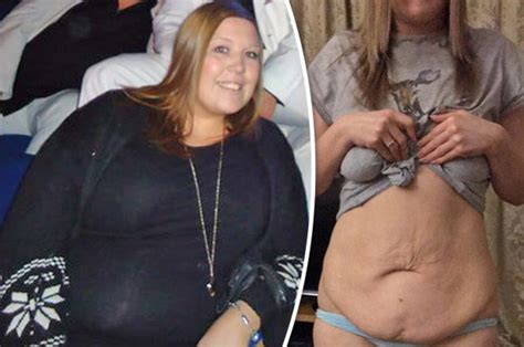 obese woman loses 9st and splashes £11k on surgery to get perfect body daily star