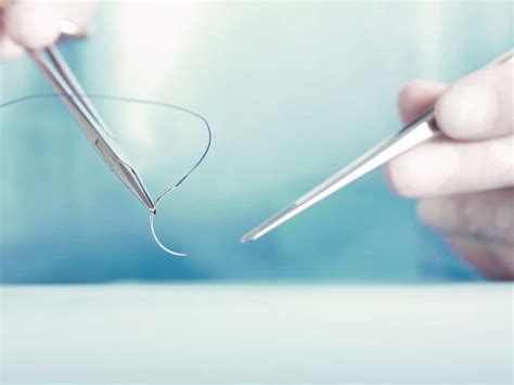 These Smart Sutures Can Detect Infections And Provide Healin