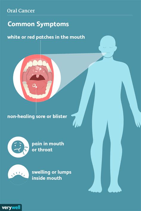 Causes Of Oral Cancer