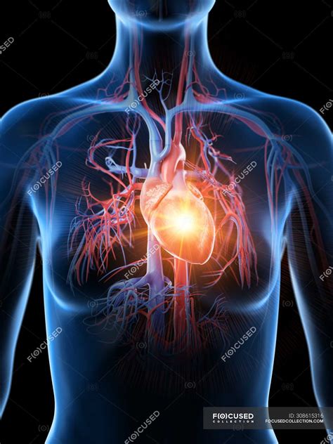 Heart Attack In Human Body Conceptual Illustration — Coronary