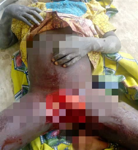 Aunt Narrates How Ritualists Completely Cut Off Private Part Of Her 6