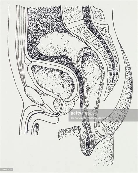Rectal Prolapse Illustration News Photo Getty Images