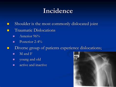 PPT Management Of Acute Shoulder Dislocation PowerPoint Presentation ID