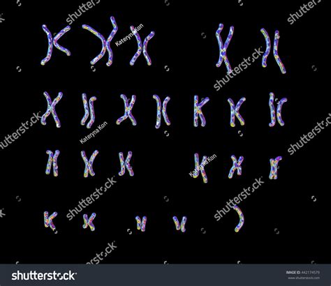 Turnerssyndrome Karyotype Unlabeled X Karyotype D Stock Illustration