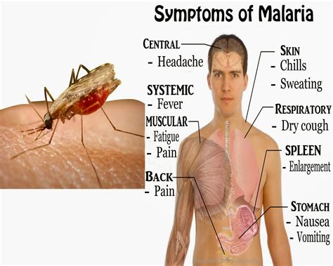 Bagi sebagian moms rambut tipis merupakan rambut yang tak sehat, karena rambut tampak lepek dan tidak bervolume. Penyakit Malaria dan Cara Mengobatinya - KRITERIATOR ...