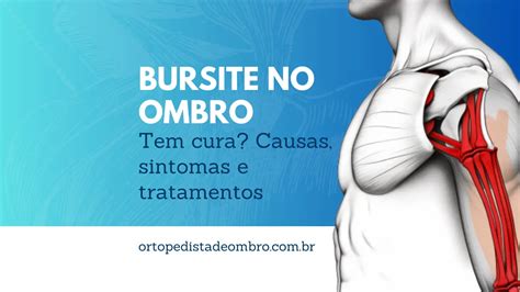 Bursite no ombro tem cura Conheça as causas sintomas e tratamentos