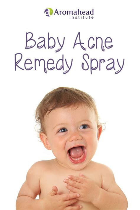Baby Acne On Face And Arms Surffishinga