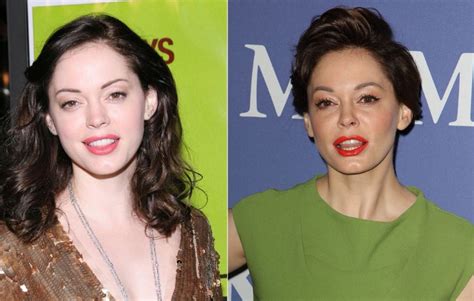 Rose Mcgowan And Plastic Surgery