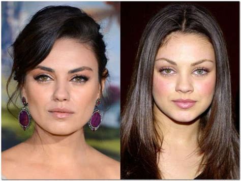 Mila Kunis Plastic Surgery Before And After Face Plastic Surgery Plastic Surgery Before After