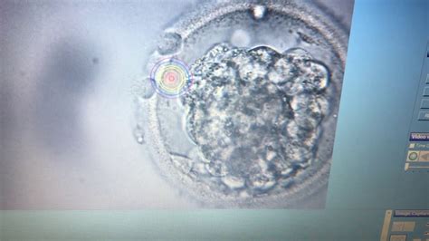 Laser Assisted Hatching Blastocyst Youtube