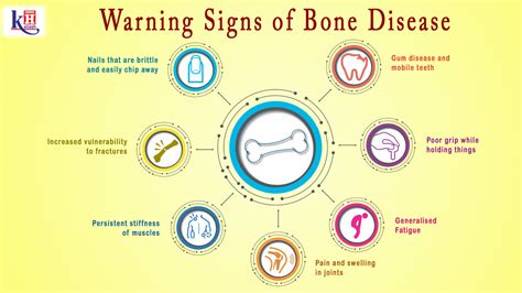 7 Warning Signs Of Bone Disease