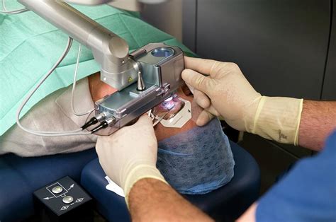 Laser Eye Surgery Photograph By Dr P Marazzi Science Photo Library
