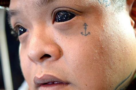 Eyeing An Eyeball Tattoo Risks High Say Experts The Straits Times
