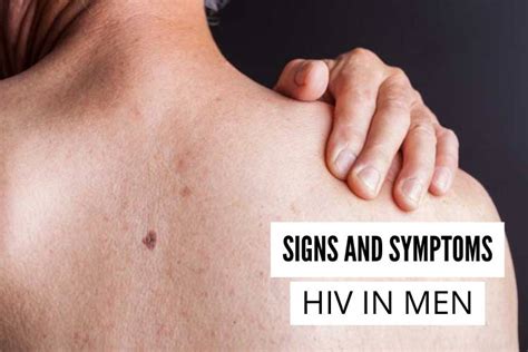 Signs And Symptoms Of Hiv In Men Author Bench