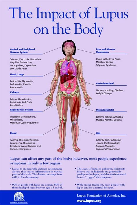 Effects Lupus Has On The Body Lupus Facts Lupus Symptoms Lupus