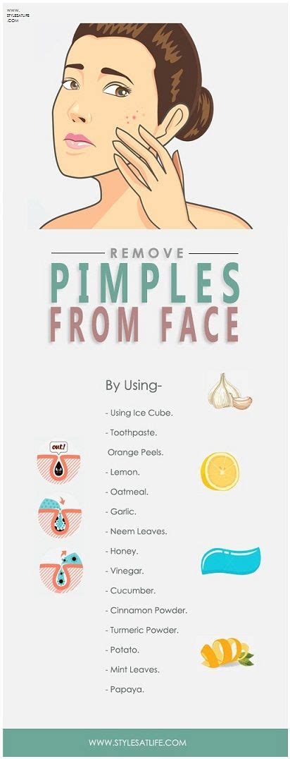 How To Remove Pimples Fast Home Remedies And Prevention Tips How To