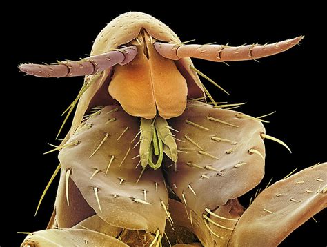 Human Flea Sem Photograph By Steve Gschmeissner
