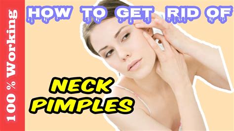 How To Get Rid Of Pimples On Neck Overnight Fast Home Remedies