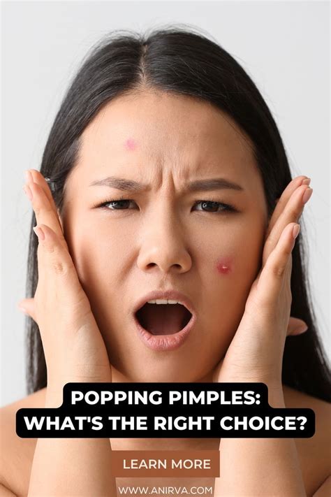Popping Pimples Whats The Right Choice Pimples Clear Skin Redness Pimple