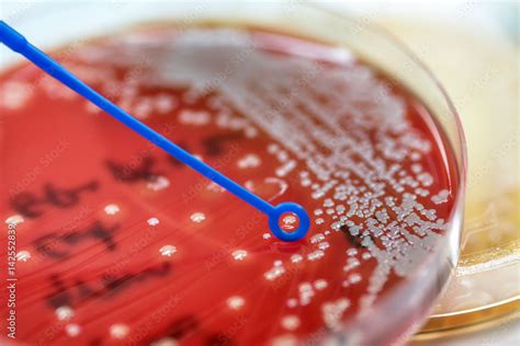 Staphylococcus Speciesm Staphylococcus Aureus To Colonies Of White Bacteria Culture On Blood