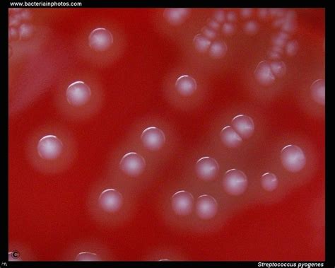 Streptococcus Pyogenes Colonies On Blood Agar Streptococcus Pyogenes