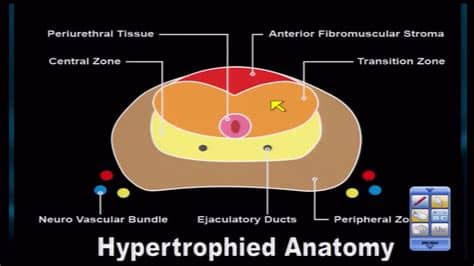 Prostate Zones Anatomy