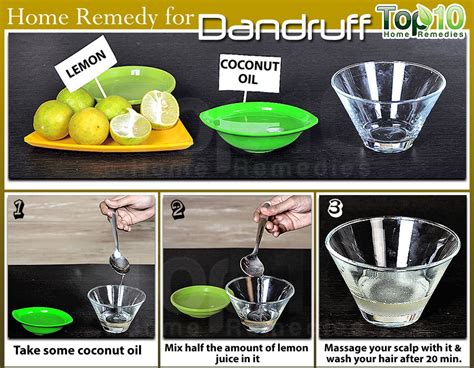 10 Simple And Efficient Ways To Get Rid Of Dandruff Permanently Viral