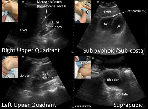 Introduction To Bedside Ultrasound