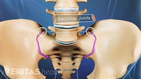 Sacroiliac Joint Dysfunction Si Joint Pain