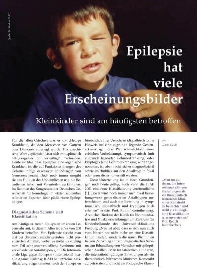 Epilepsie Hat Viele Erscheinungsbilder