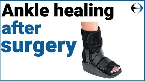 Ankle Surgery How Long Does It Take For Your Ankle To Heal After Surgery Youtube