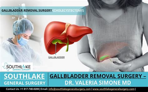 Gallbladder Removal Surgery Cholecystectomy Dr Valeria Simone Md