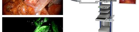 Fluorescence Imaging Guided Surgery Jansen Medicars