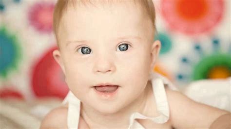 Caring For A Baby With Down Syndrome Down Syndrome Baby Down