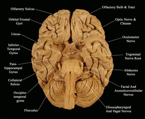 Human Brain Labeled Inferior View