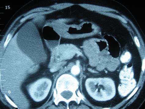 Index Of Papac13 Diagnostic Imaging Iiarchive7 Gi762 Normal