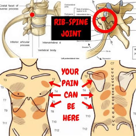 The muscles below my rib cage keep hurting. Dealing With Dislocated Ribs - Jackson Adventures