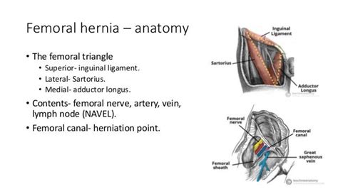 Inguinal And Femoral Hernia