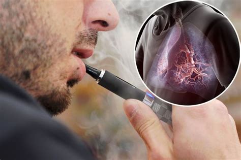 E Cigarette Flavourings Damage The Lungs Cinnamon Vape Juice Found To