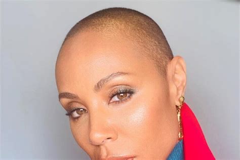 Jada Pinkett Smith Declares That She Suffers From Alopecia And Speaks
